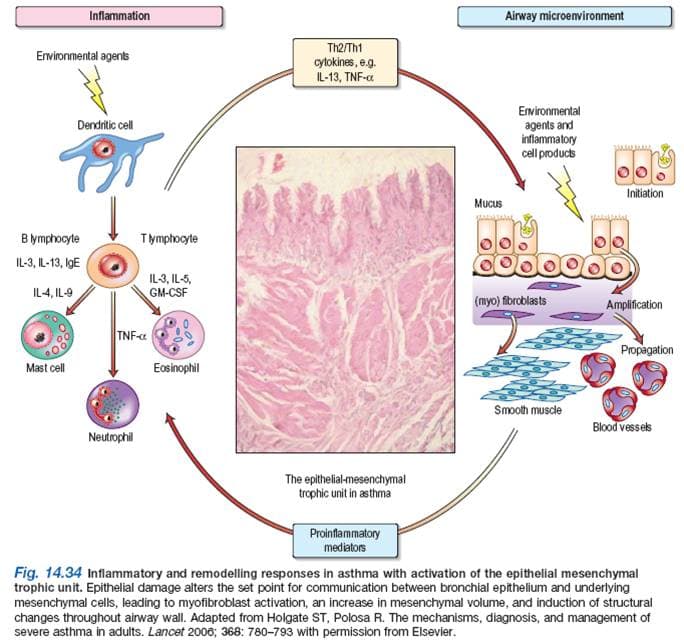 Pathophysiology Of Bronchial Asthma What Happens In Asthma Hubpages