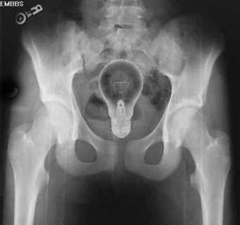 10 meest schokkende röntgenfoto's