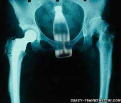 10 meest schokkende röntgenfoto's