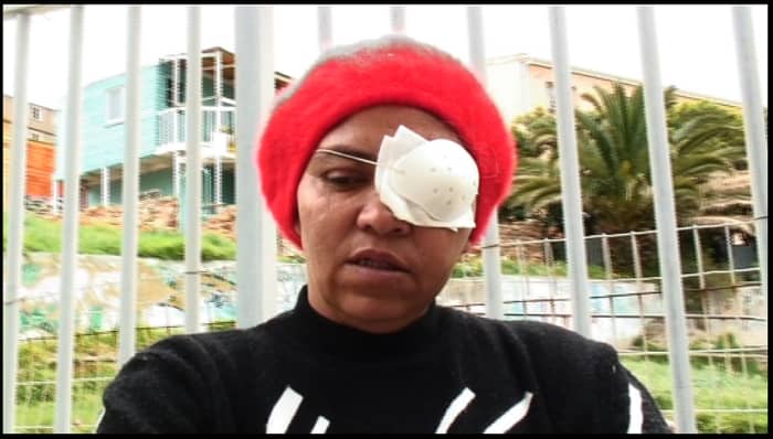 Another victim who lost an eyes, Auriol Cloete, and told of other four people whom the police had taken they eyes from them and apparently these people did nothing to suffer such a costly fate