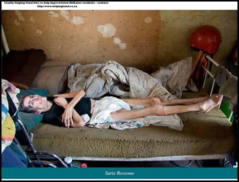 Malnutrition, poverty or HIV/AIDS is also attacking Whites in south Africa/ although Africa suffer disproportionality from all the social ills of Today's South Africa