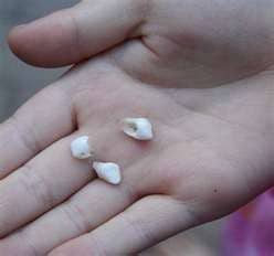 Showing different types of teeth (compliments of the "Tooth Fairy" who has been saving her child's teeth)