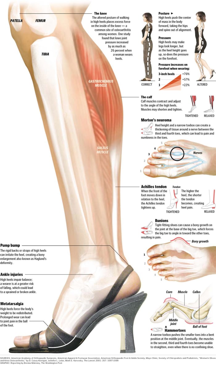 Knowledge is power! Take a closer look at this infographic to see the impact of high heeled shoes on legs.