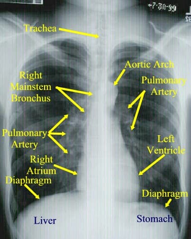 Tobacco smoke has over 40 carcinogens that can affect the respiratory system (larynx and bronchus) and urogenital system (bladder, kidney and cervix).