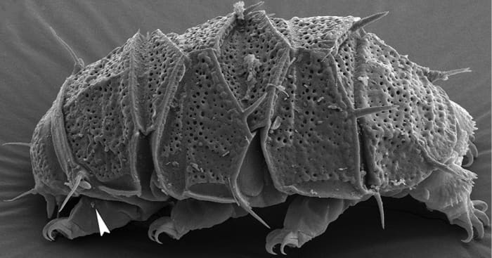 A scanning electron micrograph of a female armored tardigrade named Echiniscus succineus
