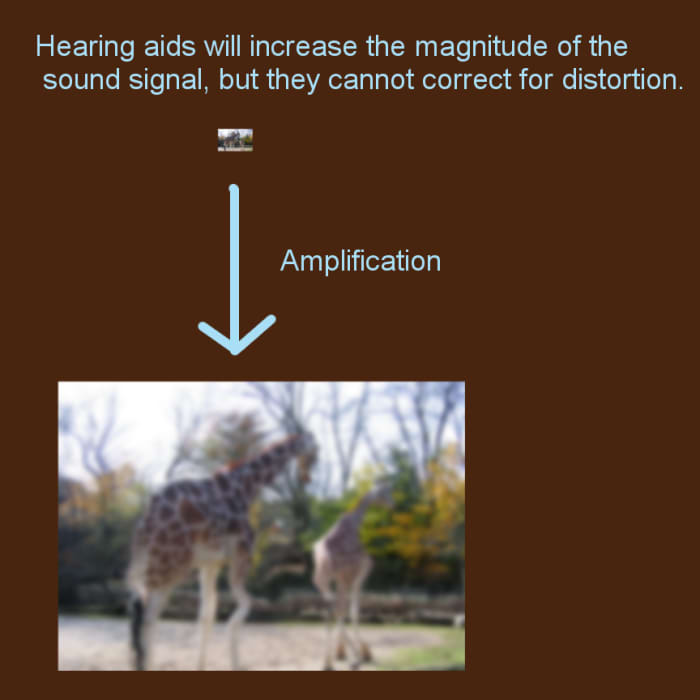 Hearing aids will make sound louder, but they cannot correct distortion caused by damaged cochlear hair cells (click to enlarge).