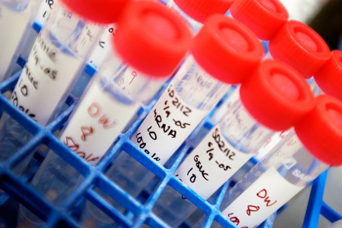 As well as getting tested by your doctor you may want to do some tests at home.