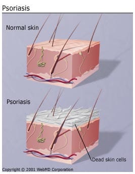 Human skin is too fragile for toxins to be removed effectively. The thick tough leathery hides of animals are able to cope with body toxin removal often in conjunction with fur, horns and scales.
