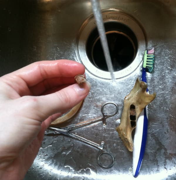 Coaxing teeth from some sockets can be tricky, so be careful not to damage any of the delicate bone around the sockets.