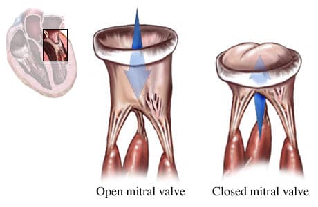The mitral valve is responsible for letting blood flow into the Left Ventricle and close after the pressure from the Left ventricle shuts it