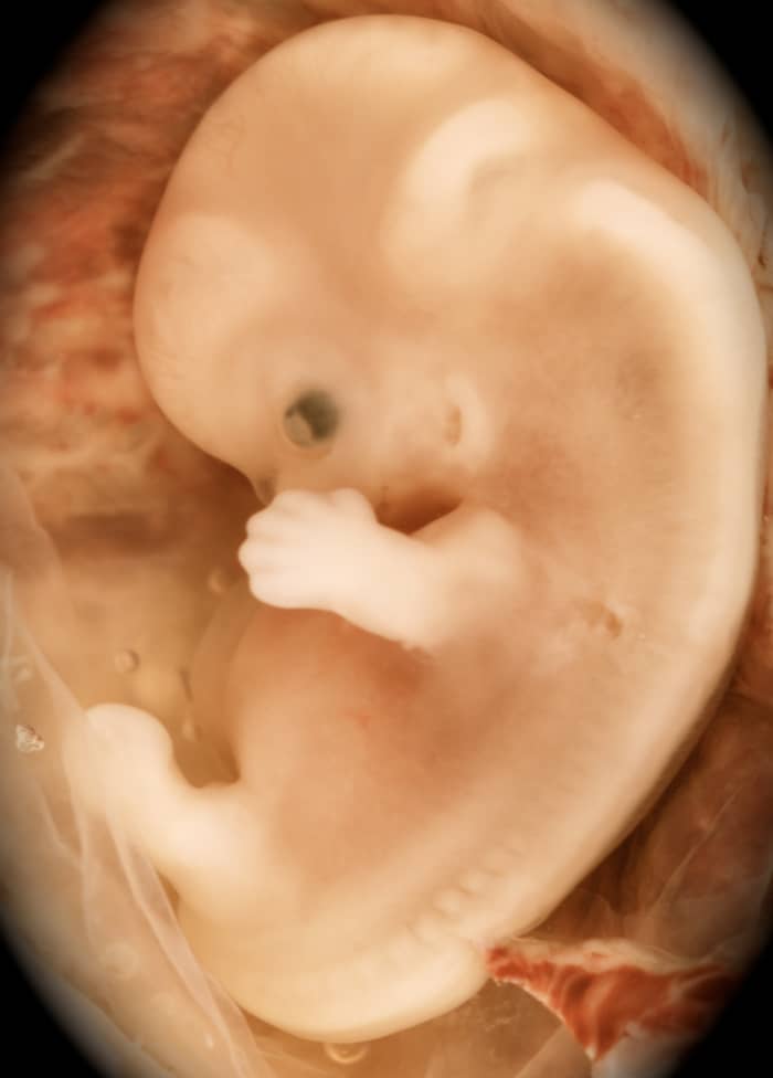 At the ninth week of development the baby has eyes, ears, mouth, spinal cord, brain, heart, vital organs, limbs, fingers and toes.