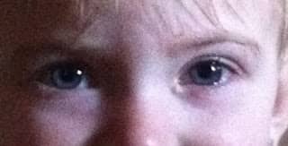 My daughter when I first noticed her eyes were different. A little bit of extra eye junk and puffiness under the eyes.
