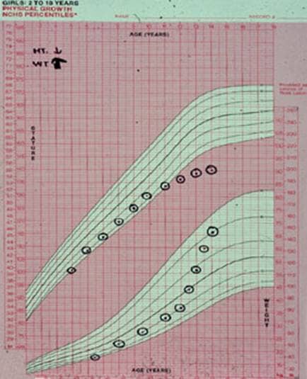 The top green portion of this chart shows a child on the smaller side since he was 2 years of age about the 5th percentile. The weight is indicated on the bottom portion of the chart. By 10 years of age this child was falling below the norms for the