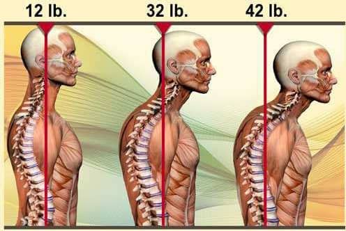 Weight of the human head with proper posture in comparison to improper posture in a colorful diagram
