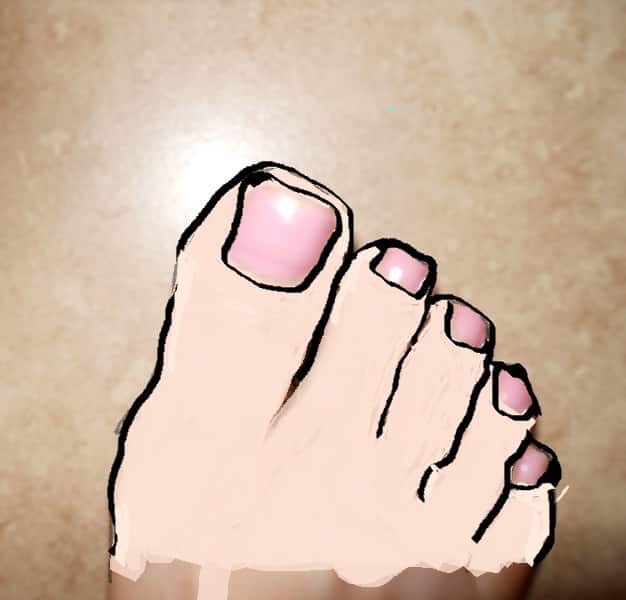 Big Toe Pain With a Surprising Diagnosis (and Easy Fix) Patient's Lounge