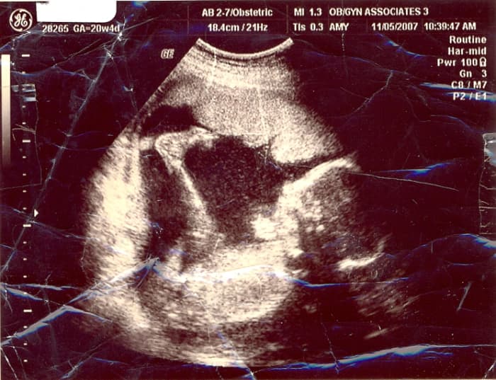 Ultrasound of my first granddaughter. Look at those long legs and big feet and toes we are known for in my family!