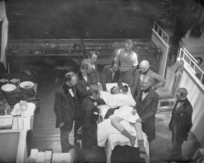 Re-enactment of the first public demonstration of general anesthesia by William T. G. Morton on October 16, 1846 in the Ether Dome at Massachusetts General Hospital, Boston. Surgeons John Collins Warren and Henry Jacob Bigelow are included in this da