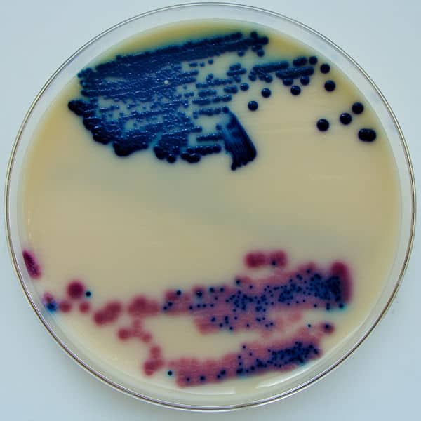 Urine cultured on Oxoid Brilliance UTI Agar plate. 1uL of urine spread onto agar surface. Top sample is from patient with clinical urinary tract infection (UTI). Bottom sample is a mixed culture.