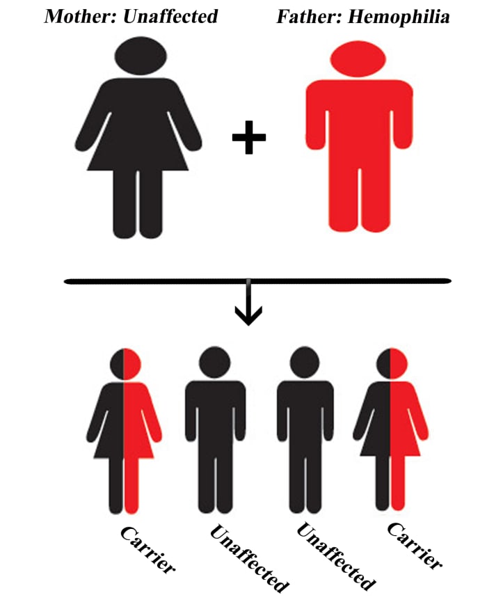When the father has Hemophilia but the mother is unaffected; Chances of sons with Hemophilia: 0%, Chances of daughters who are carriers: 100%