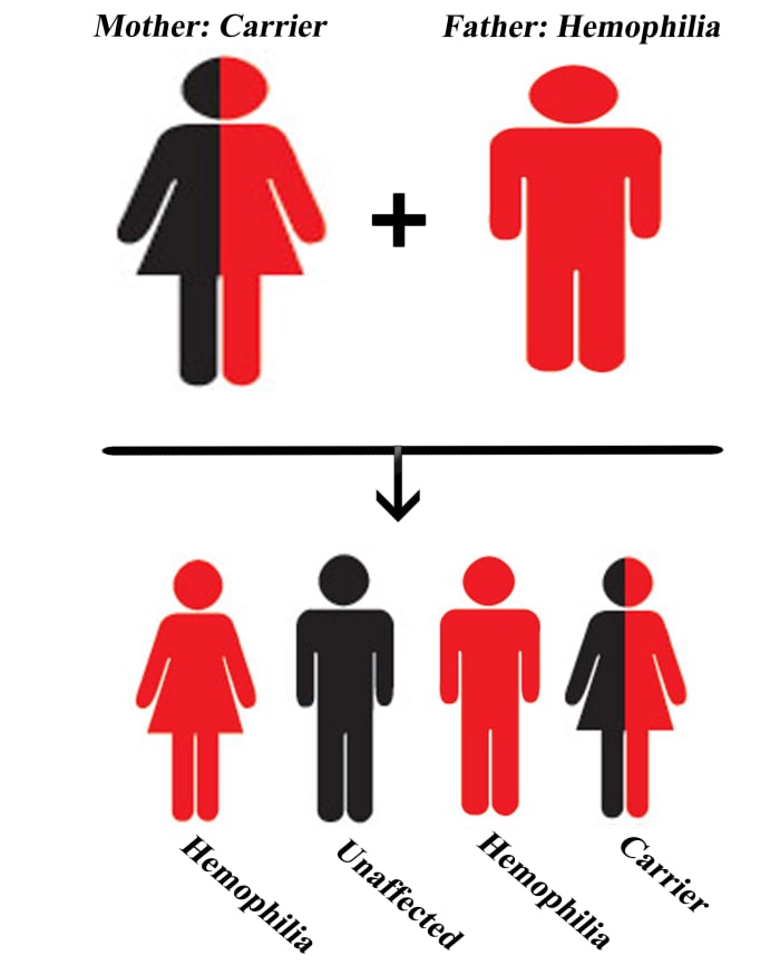 A rare case when there is a chance that a woman can have Hemophilia. When the father has Hemophilia and the mother is a carrier.; Chances of sons with Hemophilia: 50%, Chances of daughters who are either carrier or have Hemophilia: 50%
