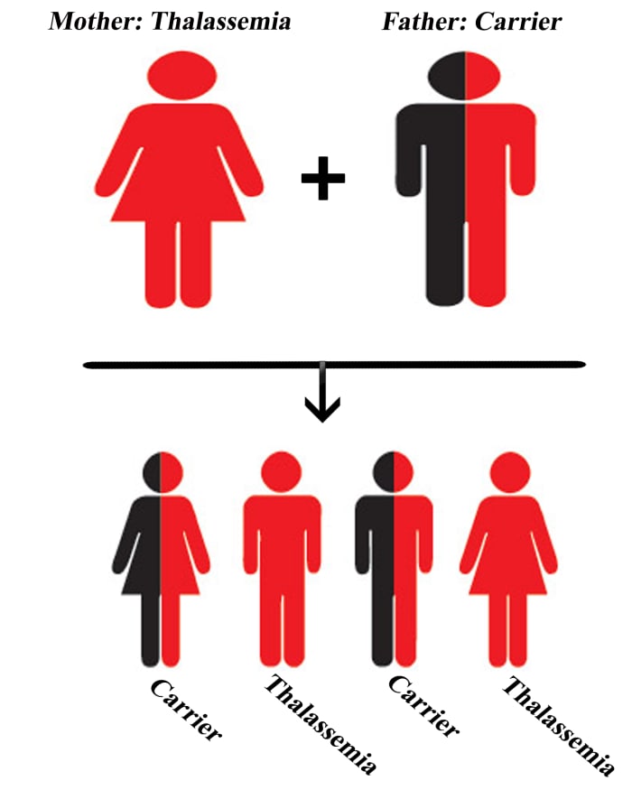 When the mother has thalassemia and the father is a carrier; Chances for children with thalassemia: 50%, Chances for children who are carriers: 50%