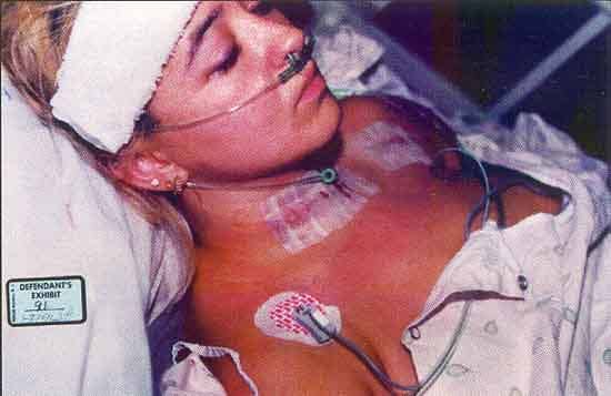 Darlie in the hospital with her wounds. This photo was taken in the ICU. Darlie must have put her earrings back in for the photo. Operating room staff remove ALL jewelry before any type of surgery and the nasal cannula tubing would rub on the earring