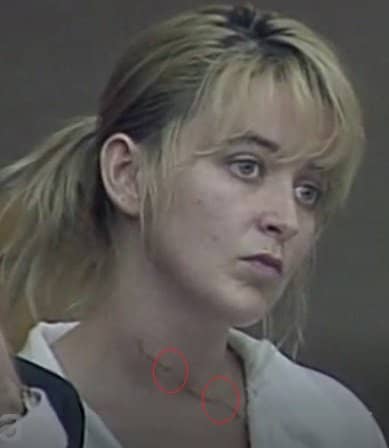 Forensic pathologists have noted that Darlie's neck wound appeared to have at least 2 hesitation areas and it was crooked, indicating self infliction; where if this were a slash during a fight, it would most likely be a nonstop straight laceration.