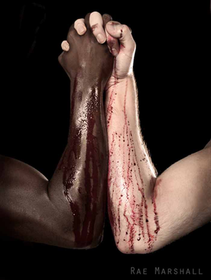Armed conflict between black and white only serves the interests of the political classes who play one against the other for their own personal gain.
