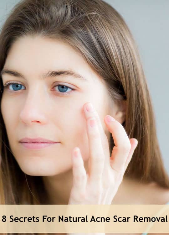 Acne scars basically have two major types (i.e. depressed and raised), and each type needs different treatment options. What treatment best suits your needs?