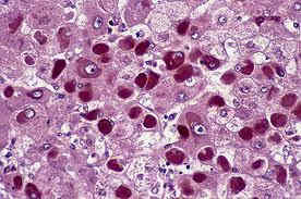 Cells stained with orcein.