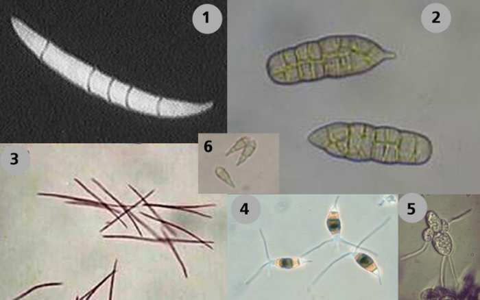 Fungal spore types that cause gray leaf spots in various plants: (1) Cercospora, (2) Stemphyllium, (3) Septoria, (4) Pestalotia, (5) Entomosporium and (6) Pyricularia grisea. Microscope magnification around 300X.