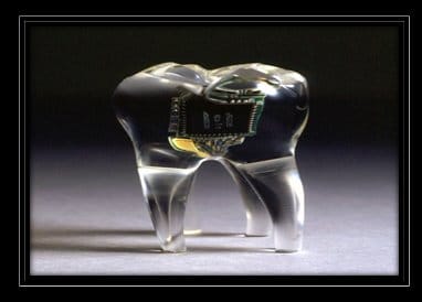 A wireless receiver can be implanted into your tooth with the aid of basic dental surgery. The implant can allow a person to receive digital signals from radios and mobile phones, from the privacy of their own head.