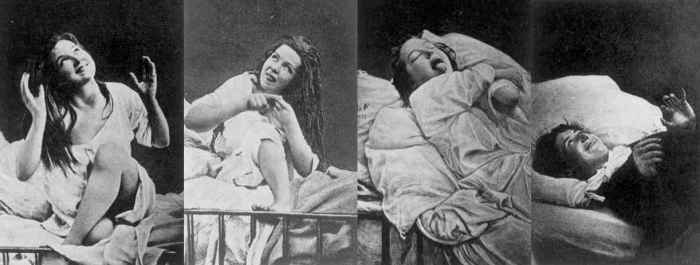 In this disorder, the patient gets detached from reality and may become almost immobile and immersed in his own self or in some other “divine power”.