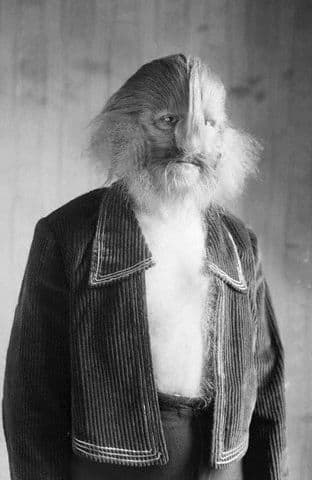 Stephan Bibrowski also known as Lionel the Lion-faced Man, was a circus freak show performer who suffered from hypertrichosis.