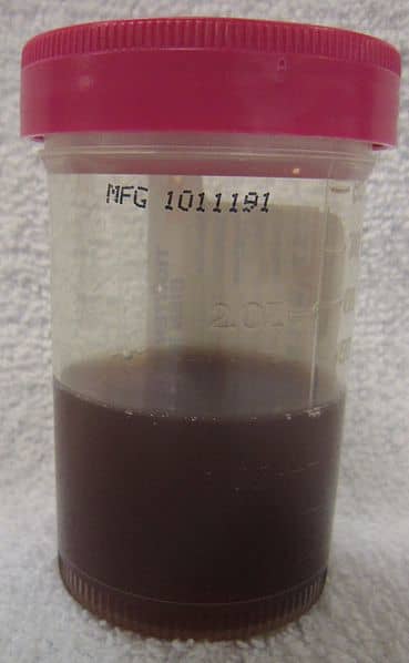 listen-to-what-your-urine-tells-you