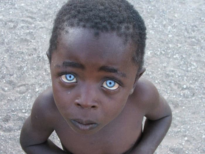The picture is called The Boy with the Sapphire Eyes. As soon as photographer Vanessa Bristow posted it she was flooded with accusations of photoshop. She responded by posting other pictures of the boy as it is in fact not altered. The blue eyes and