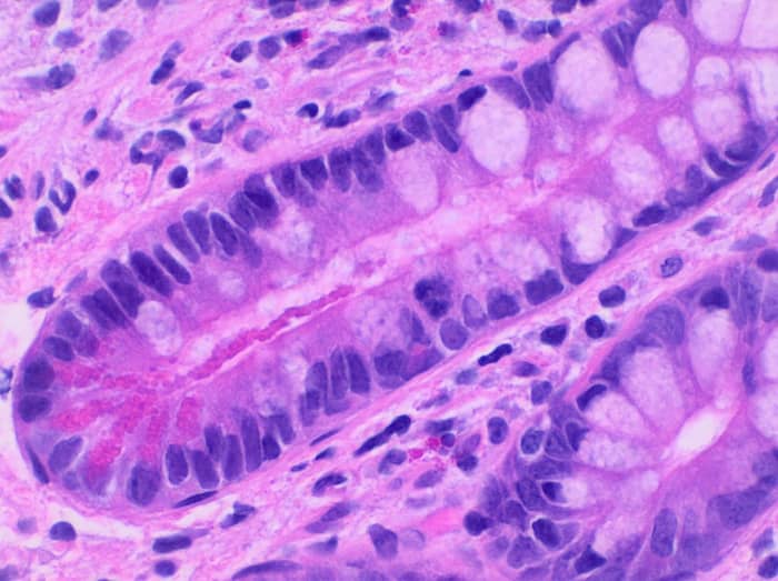 Stained Paneth cells (the large structures)