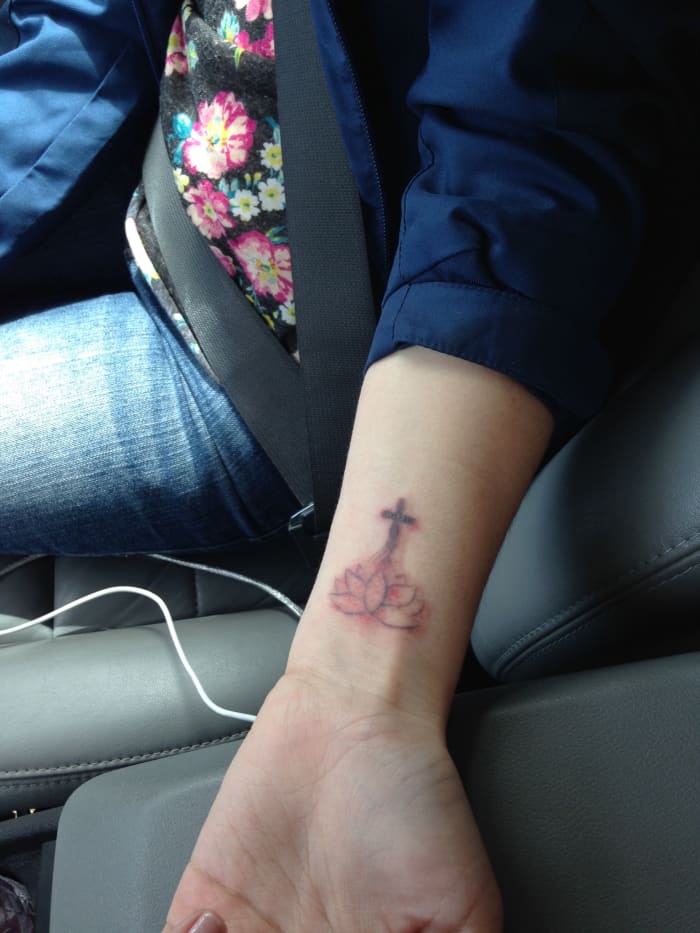 After your laser session, your tattoo will swell and look incredibly irritated. Do not pick at it and it will heal just fine. This is a photo from my 3rd removal session.