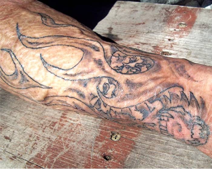 burn victim wrap for tattoo