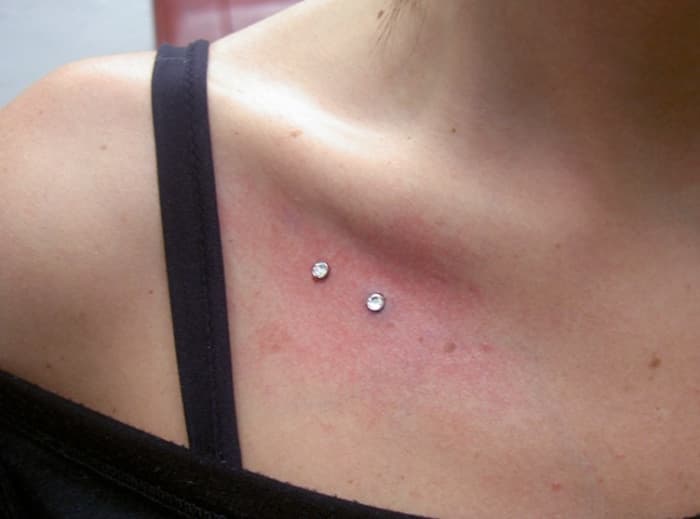 Dermal Piercing Procedure Care Scar Removal And More Tatring