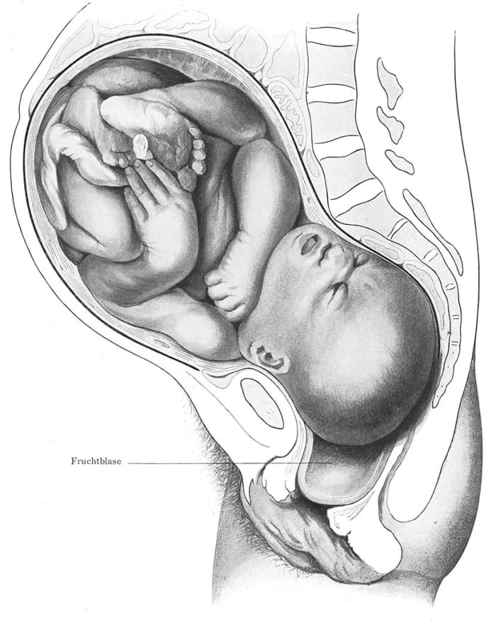 Normally, babies are in a head-down position during childbirth.