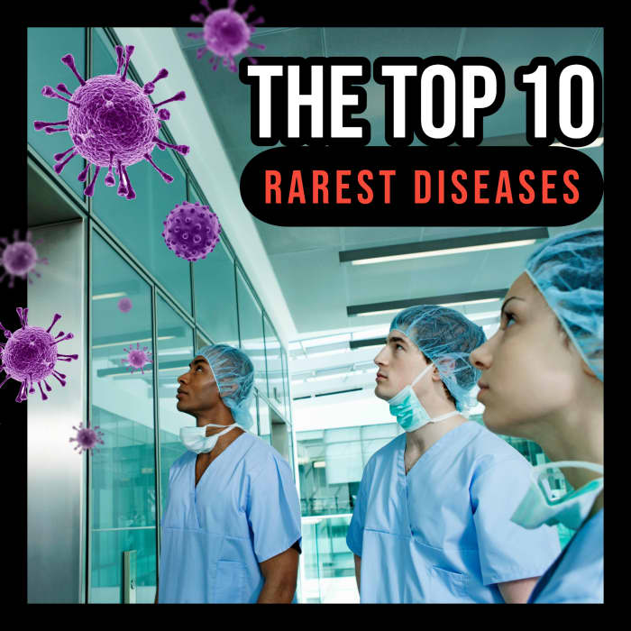 The Top 10 Rarest Diseases - YouMeMindBody