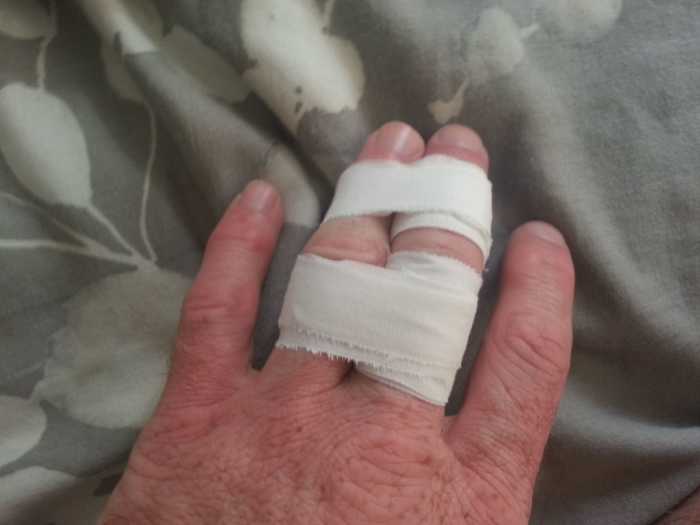 How to tape a finger for BJJ HubPages