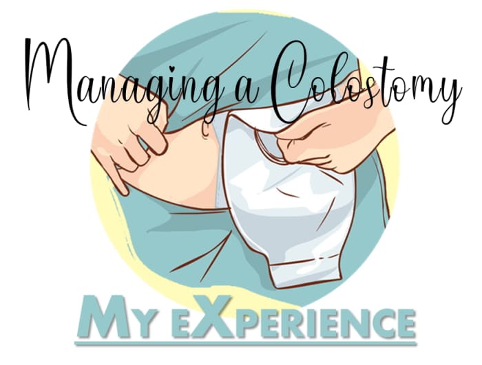 Managing A Colostomy After Colon Surgery: My Experience - Patient's Lounge