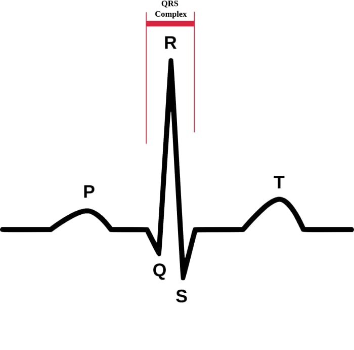 How to Read EKGs – Normal Sinus Rhythm - HubPages