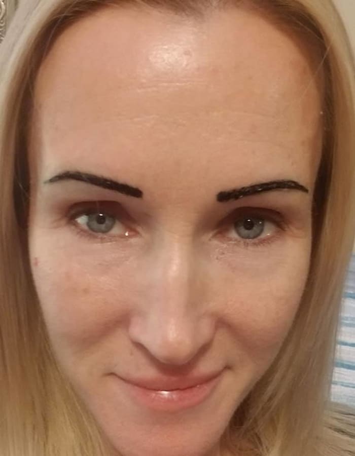 This was a picture of me at the end of summer right before I started using Rapid Wrinkle Repair. At this time I was using Castor Oil and Rose Hip Oil.