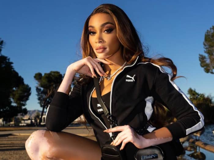Super-model Winnie Harlow got her big break as a competitor on America's Next Top Model in 2014.