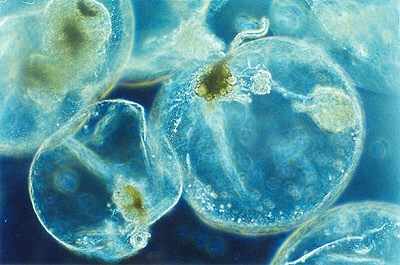 Noctiluca scintillans