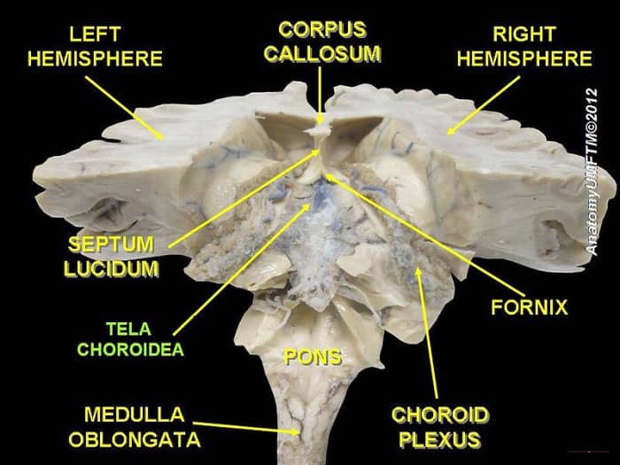 "The choroid plexus is a complex network of capillaries lined by specialized cells and has various functions"(Jarvis et al., 2020).