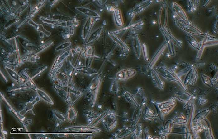 Diatomaceous earth viewed under a microscope.